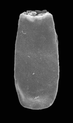 <i><i>Chitinozoa</i> | Conochitina sp. 6  Nestor, 1994</i><br />Ventspils D-3 borehole, 827.60 m, Telychian ( 423-6)