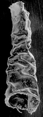 <i><i>Spinachitina</i> | Spinachitina sp.</i><br />Ikla borehole, 514.60 m, Juuru Stage ( 272-151)