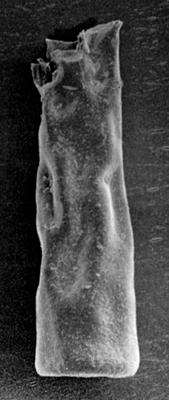 <i><i>Chitinozoa</i> | Conochitina sp. 4 Nestor, 1984</i><br />Pulli 1 borehole, 59.80 m, Adavere Stage ( 223-3)