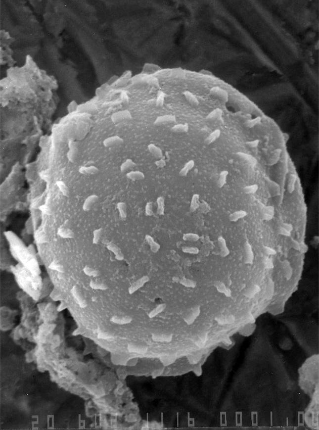 Taeniosphaeridium Fossiilid.info