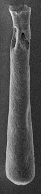 <i><i>Chitinozoa</i> | Conochitina sp. d Nestor, 1982</i><br />Ohesaare borehole, 161.00 m, Jaagarahu Stage (220-62)
