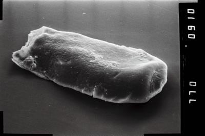 <i><i>Conochitina</i> | Conochitina sp.</i><br />Häädemeeste 172 borehole, 232.40 m, Raikküla Stage (754-1013)