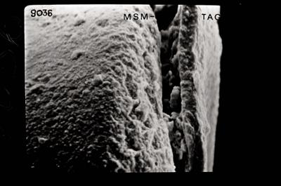 <i><i>Conochitina</i> | Conochitina sp. aff. tuba</i><br />Ohesaare borehole, 161.00 m, Jaagarahu Stage (754-643)