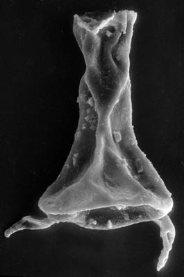 <i><i>Chitinozoa</i> | Plectochitina cf. spongiosa (Achab, 1977)</i><br />Viki borehole, 226.40 m, Juuru Stage (272-51)