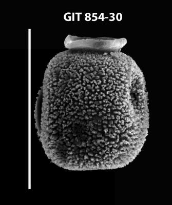 <i><i>Desmochitina erinacea</i></i><br />Baldone 80 borehole,  m, Kunda Stage (854-30)