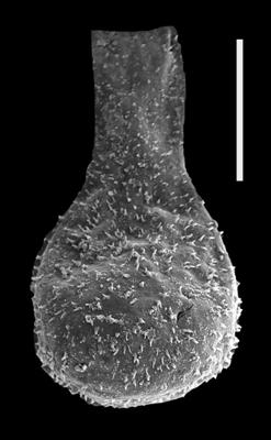 <i><i>Sphaerochitina sphaerocephala</i></i><br />Pavilosta 51 borehole, 619.50 m, Přidoli (607-41)