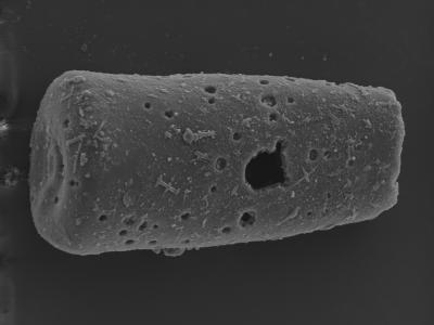 <i><i>Conochitina</i> | Conochitina sp. A (Nestor, 2007)</i><br />Kolka 54 borehole, 399.80 m, Rootsiküla Stage (754-317)