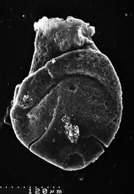 <i><i>Lagenochitina</i> | Lagenochitina sp.</i><br />Varangu stratotype outcrop,  m, Tremadocian (1537-15)