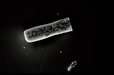 <i><i>Conochitina</i> | Conochitina sp.</i><br />Varbla 502 borehole, 171.95 m, Raikküla Stage (754-163)