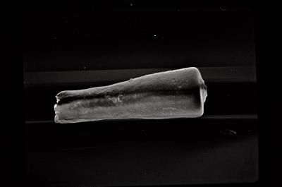 <i><i>Conochitina</i> | Conochitina sp. sp.</i><br />Ohesaare borehole, 202.85 m, Jaagarahu Stage (754-634)