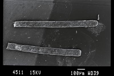 <i><i>Rhabdochitina</i> | Rhabdochitina sp.</i><br />Gussev 1 borehole, Kaliningrad oblast, 1467.80 m, Rootsiküla Stage (754-10)