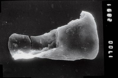 <i><i>Sphaerochitina indecora</i></i><br />Ruhnu 500 borehole, 309.00 m, Jaagarahu Stage (754-852)