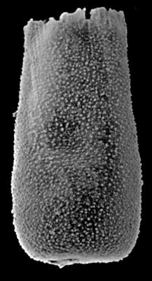 <i><i>Chitinozoa</i> | Belonechitina? granosa (Laufeld, 1974)</i><br />Ohesaare borehole, 79.20 m, Kuressaare Stage (189-34)