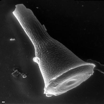 <i><i>Chitinozoa</i></i><br />Tähkvere 726 puurauk,  m, Vormsi Stage (1543-3)