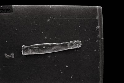 <i><i>Conochitina</i> | Conochitina sp. sp. </i><br />Ruhnu 500 borehole, 402.80 m, Jaagarahu Stage (754-137)