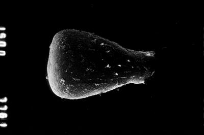 <i><i>Belonechitina cactacea</i></i><br />Ruskavere 451 borehole, 120.20 m, Nabala Stage (660-881)