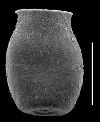 <i><i>Chitinozoa</i> | Desmochitina sp. group minor Eisenack, 1931</i><br />Museum of Art excavation section, Kadriorg, 0.30 m, Hunneberg Stage (424-64)