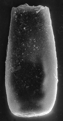 <i><i>Chitinozoa</i> | Conochitina sp. 6  Nestor, 1994</i><br />Ohesaare borehole, 356.26 m, Adavere Stage (272-144)