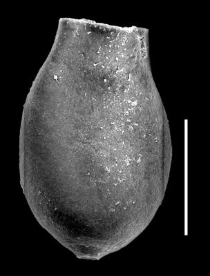 <i><i>Chitinozoa</i> | Desmochitina sp. A, aff. bulla Taugourdeau et de Jekhowsky, 1960</i><br />Museum of Art excavation section, Kadriorg, 0.30 m, Hunneberg Stage (424-62)