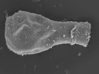 <i><i>Sphaerochitina lycoperdoides</i></i><br />Ohesaare borehole, 146.95 m, Rootsiküla Stage (754-363)