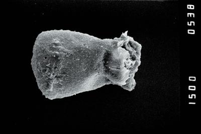 <i><i>Conochitina</i> | Conochitina sp. a</i><br />Ohesaare borehole, 163.60 m, Jaagarahu Stage (754-1220)