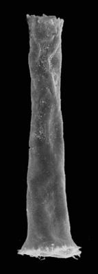 <i><i>Chitinozoa</i> | Spinachitina suecica (Laufeld, 1967)</i><br />Kerguta 565 borehole, 143.22 m, Haljala Stage (544-30)