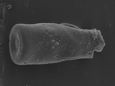 <i><i>Conochitina</i> | Conochitina sp. A (Nestor, 2007)</i><br />Kolka 54 borehole, 399.80 m, Rootsiküla Stage (754-318)