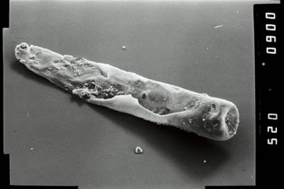 <i><i>Conochitina</i> | Conochitina sp. 4</i><br />Varbla 502 borehole, 149.10 m, Adavere Stage (754-1953)