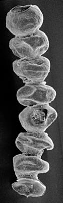 <i><i>Calpichitina densa</i> | Desmochitina densa Eisenack, 1962</i><br />Pulli 2 borehole, 37.25 m, Jaani Stage (220-4)