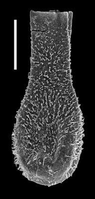 <i><i>Angochitina echinata</i></i><br />Pavilosta 51 borehole, 584.30 m, Přidoli (607-33)