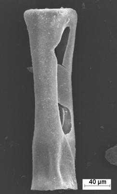 <i><i>Conochitina</i> | Conochitina sp.3</i><br />Staicele 4 borehole, 373.00 m, Raikküla Stage (754-1364)