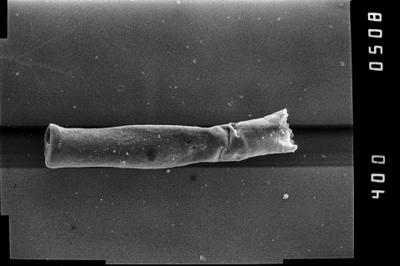 <i><i>Conochitina</i> | Conochitina sp. 4</i><br />Kirikuküla borehole, 47.90 m, Adavere Stage (754-1184)