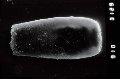 <i><i>Conochitina</i> | Conochitina sp. 6</i><br />Ohesaare borehole, 356.26 m, Adavere Stage (754-923)
