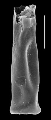 <i><i>Chitinozoa</i> | Conochitina cf. elongata Taugourdeau, 1963</i><br />Paatsalu 527 borehole, 111.50 m, Llandovery (493-8)