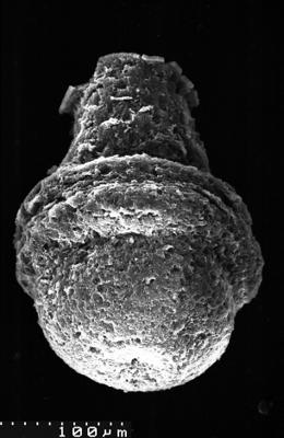 <i><i>Chitinozoa</i> | Kitiiniku laadne mikrofosiil</i><br />Varangu stratotype outcrop,  m, Tremadocian (1537-7)