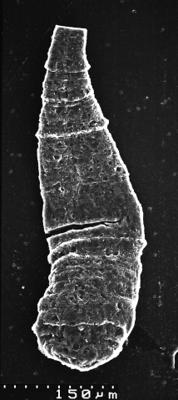 <i><i>Chitinozoa</i> | Kitiiniku laadne mikrofosiil</i><br />Varangu stratotype outcrop,  m, Tremadocian (1537-5)