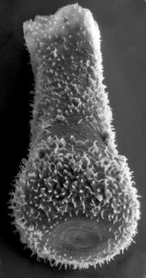 <i><i>Chitinozoa</i> | Sphaerochitina? sp. 3 Nestor, 1994</i><br />Ruhnu 500 borehole, 589.20 m, Juuru Stage (272-206)