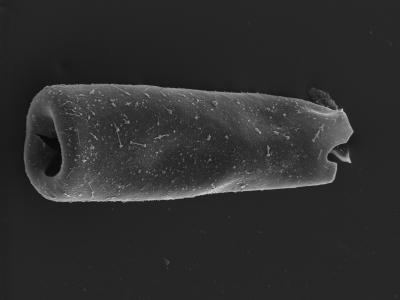 <i><i>Conochitina</i> | Conochitina sp.</i><br />Kolka 54 borehole, 405.50 m, Jaagarahu Stage (754-1295)