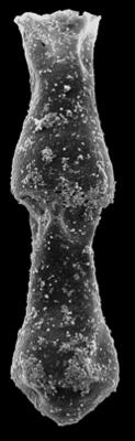 <i><i>Chitinozoa</i> | Linochitina sp. A Loydell et al., 2010</i><br />Kolka 54 borehole, 422.80 m, Jaagarahu Stage (546-95)