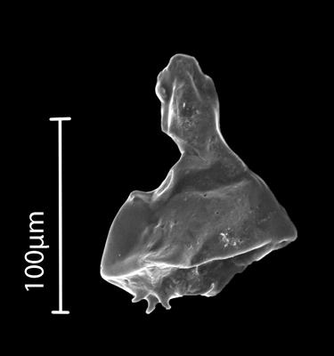 <i><i>Ancyrochitina</i></i><br />Bebirva 111 borehole, 1103.95 m, Ludfordian (902-20)
