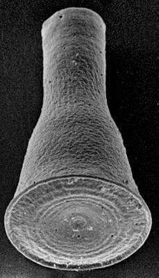 <i><i>Cyathochitina campanulaeformis</i></i><br />Seliste 173 borehole, 340.30 m, Juuru Stage (272-158)