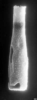 <i><i>Chitinozoa</i></i><br />Tähkvere 726 puurauk,  m, Vormsi Stage (1543-32)