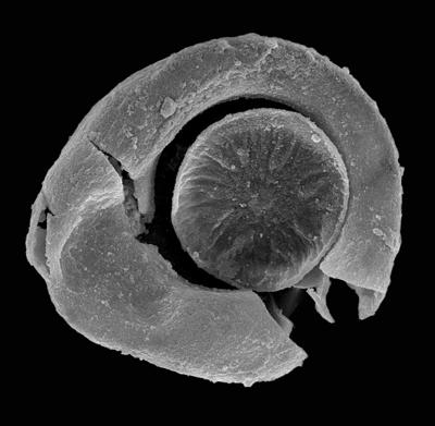 <i><i>Chitinozoa</i> | Calpichitina aff. acollaris (Eisenack, 1959)</i><br />Ohesaare borehole, 338.25 m, Jaani Stage (427-31)