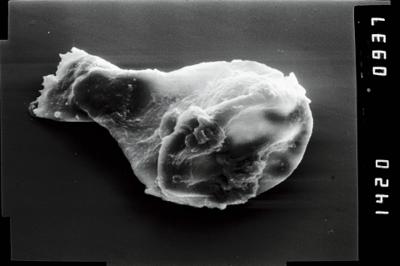 <i><i>Plectochitina</i> | Plectochitina cf. spongiosa</i><br />Nurme borehole, 104.10 m, Juuru Stage (754-1025)