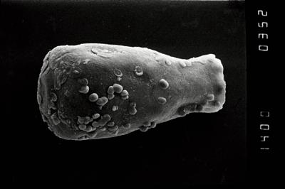 <i><i>Conochitina</i> | Conochitina sp. a</i><br />Ohesaare borehole, 163.90 m, Jaagarahu Stage (754-1095)