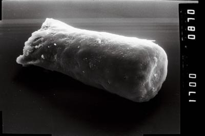 <i><i>Conochitina</i> | Conochitina sp.</i><br />Viluvere 324 borehole, 51.70 m, Adavere Stage (754-1928)