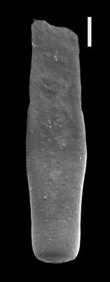 <i><i>Chitinozoa</i> | Rhabdochitina sp.1</i><br />Ventspils D-3 borehole, 404.00 m, Přidoli (607-18)