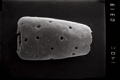 <i><i>Conochitina</i> | Conochitina sp.a</i><br />Ohesaare borehole, 198.80 m, Jaagarahu Stage (754-1072)