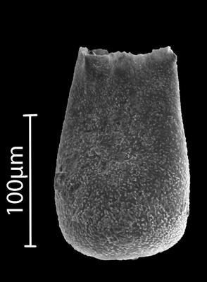 <i><i>Eisenackitina barrandei</i></i><br />Bebirva 111 borehole, 1127.95 m, Ludfordian (902-11)