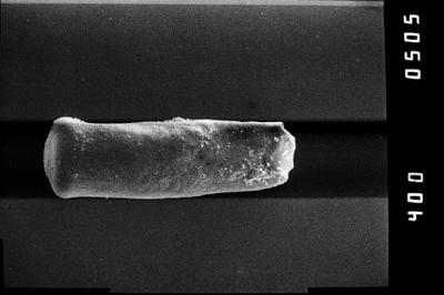 <i><i>Conochitina</i> | Conochitina sp. 2</i><br />Kirikuküla borehole, 47.90 m, Adavere Stage (754-1187)